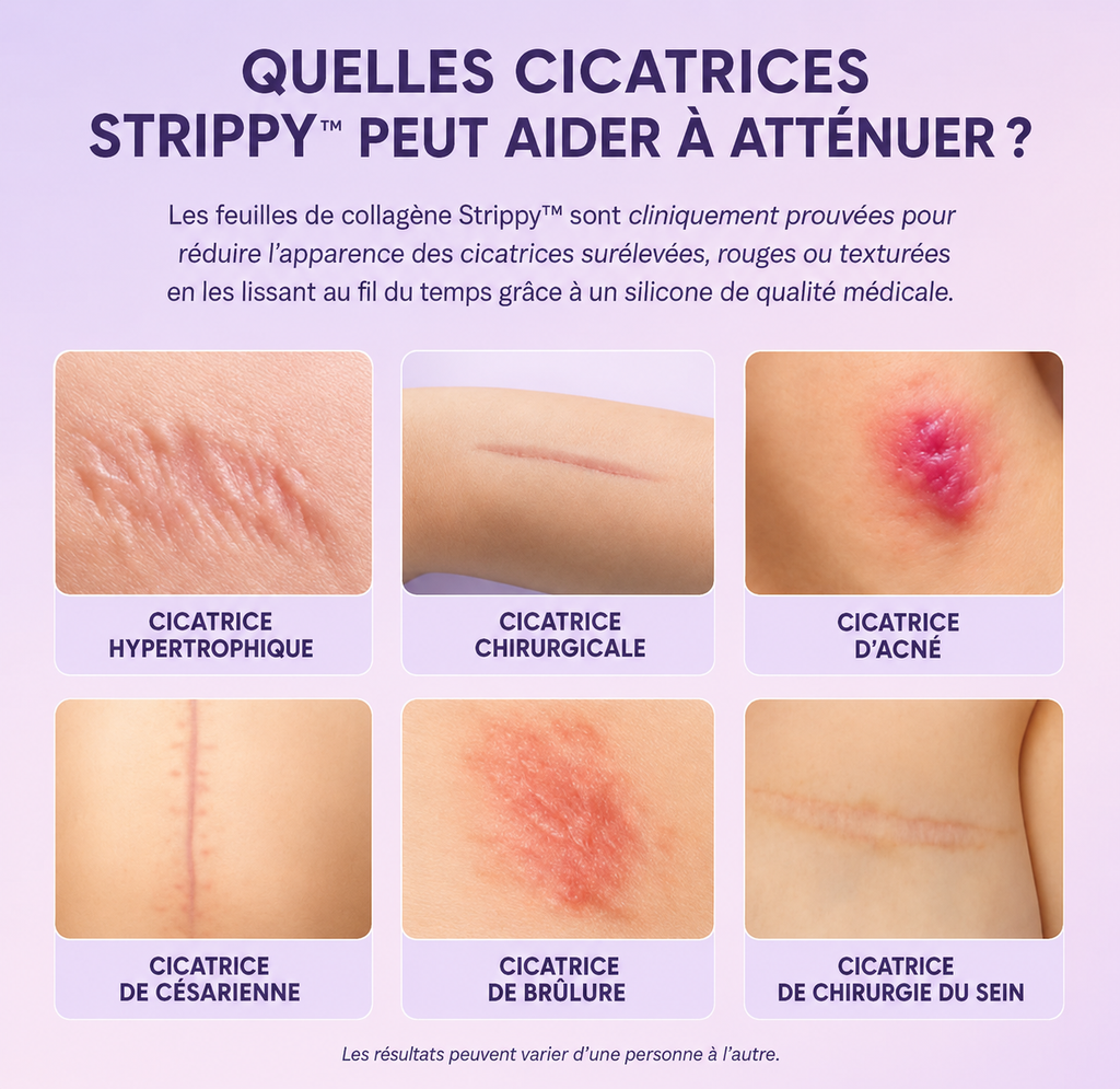 Strippy™ Patchs Beauté en Silicone