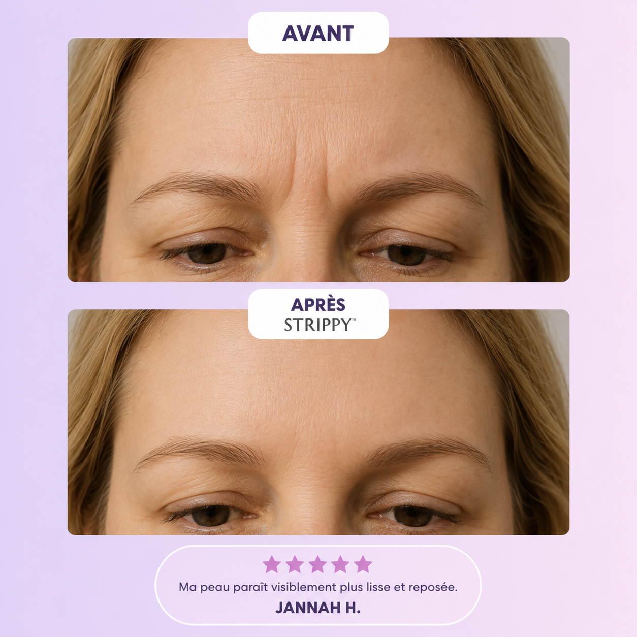 Miniature produit STRIPPY 3