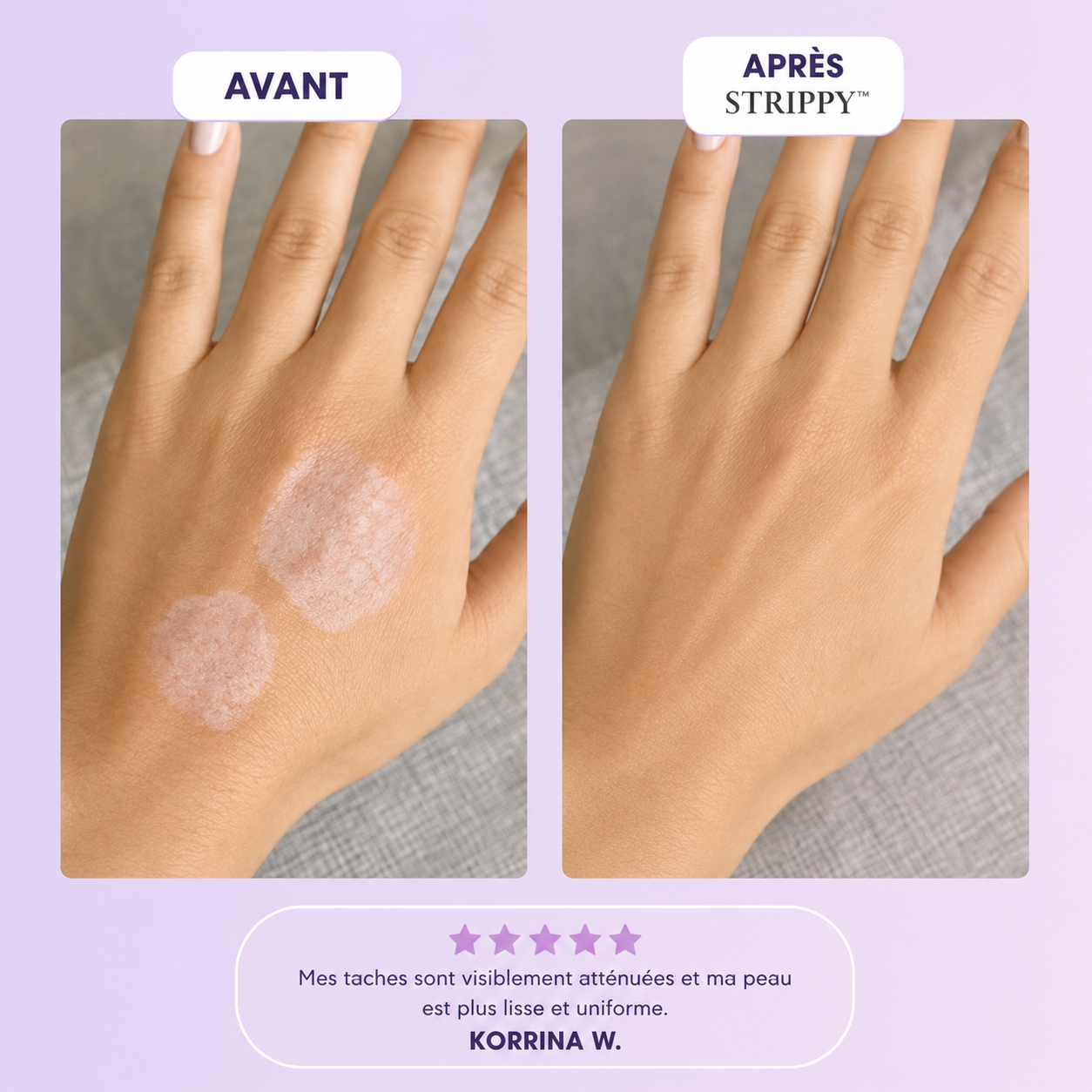 Miniature produit STRIPPY 4