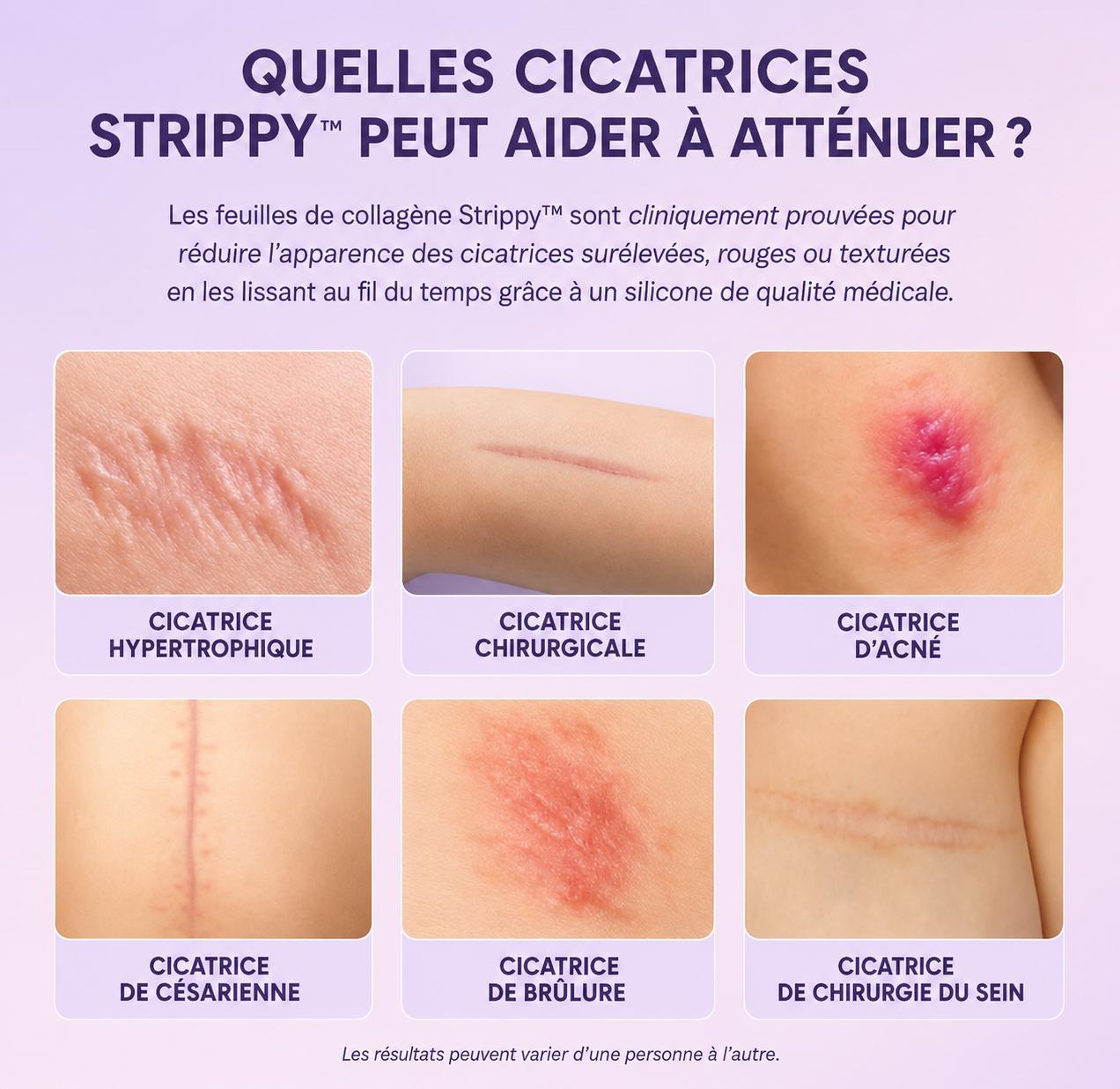 Miniature produit STRIPPY 6